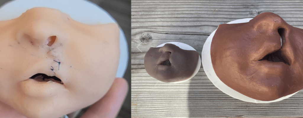 Cleft lip suture training model from Dr. Jordan Virbalas, UCSF Otolaryngology-Head and Neck Surgery (left) and Kelsey Ogomori, UCSF MD Candidate (right)