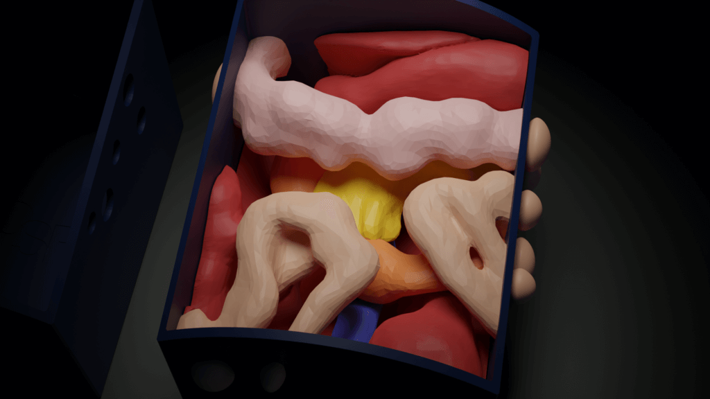 3D render of the abdominal hemorrhage simulator