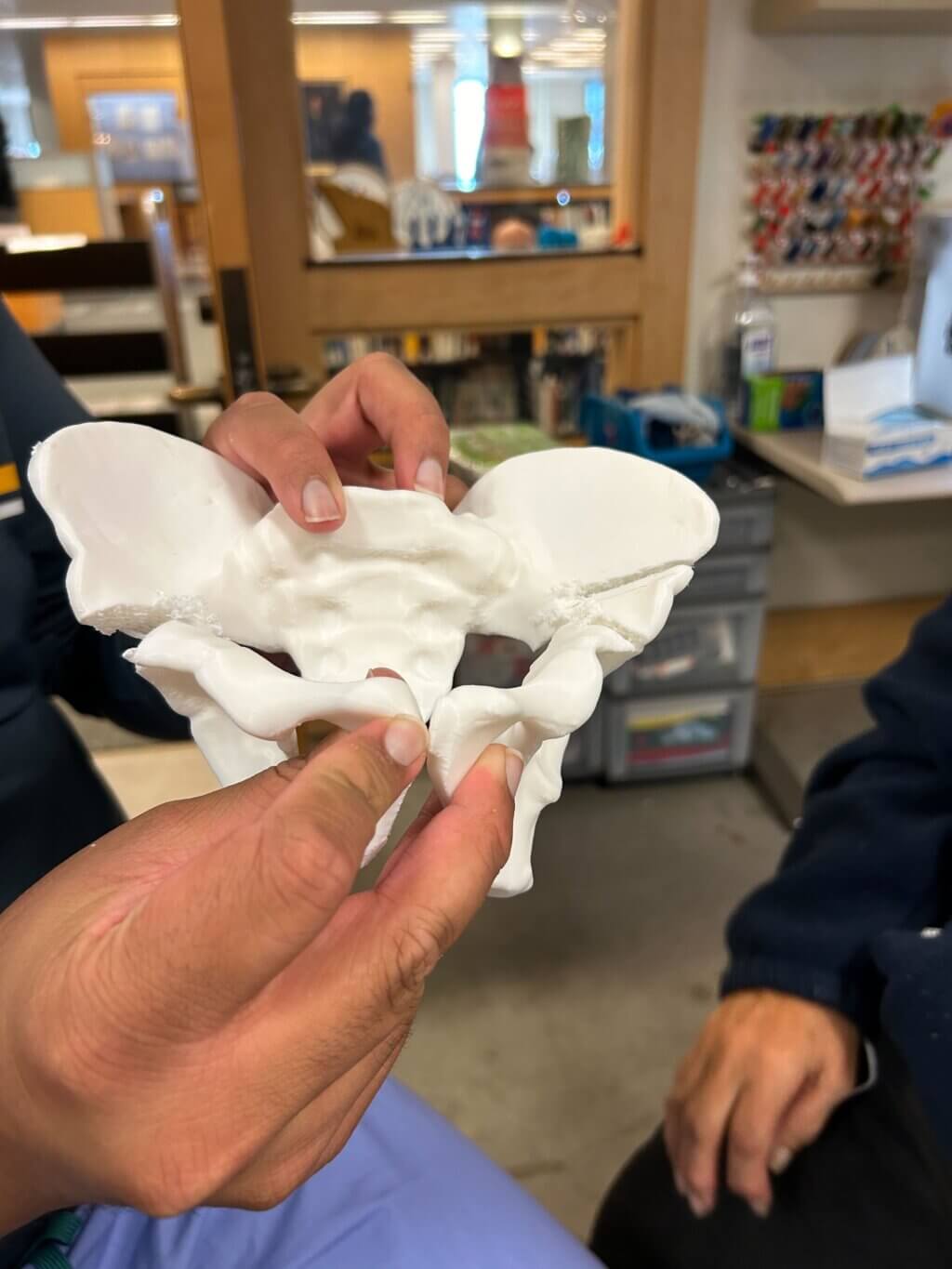 Osteotomy test cut results on an initial print