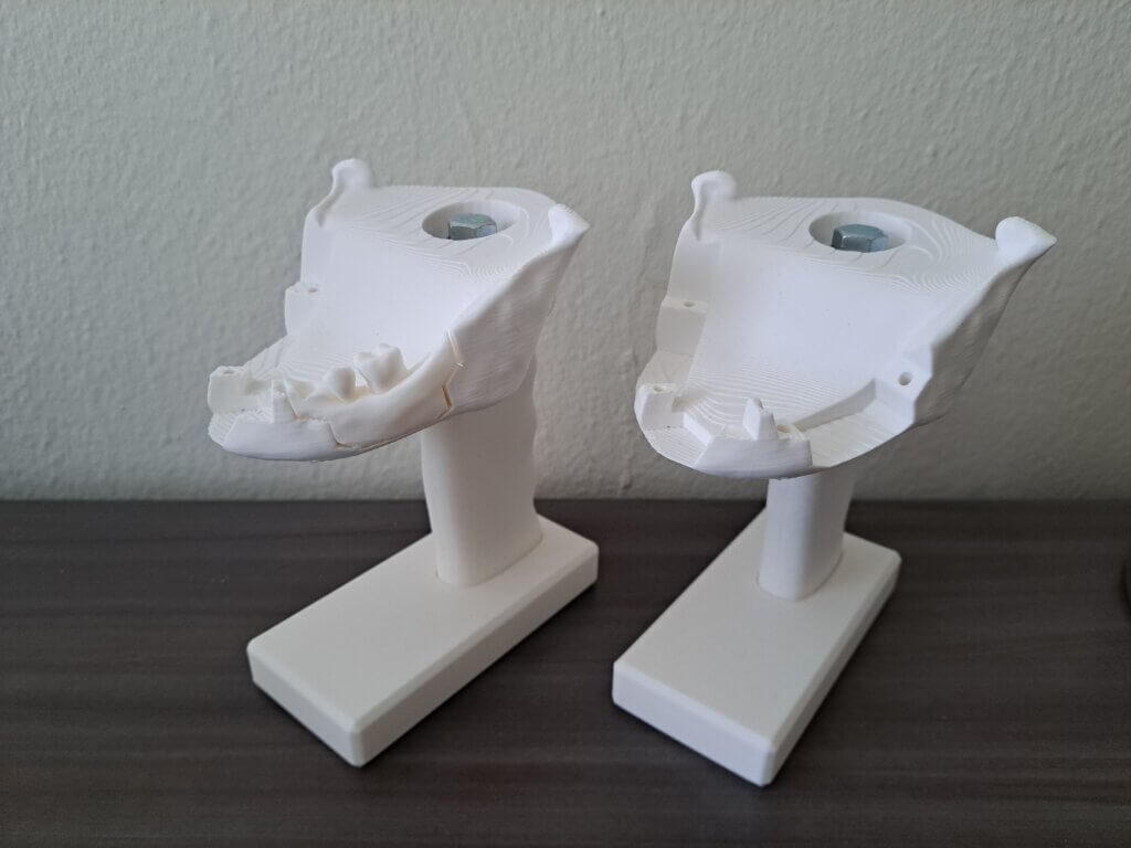 A pair of tooth-extraction models with replaceable tooth modules