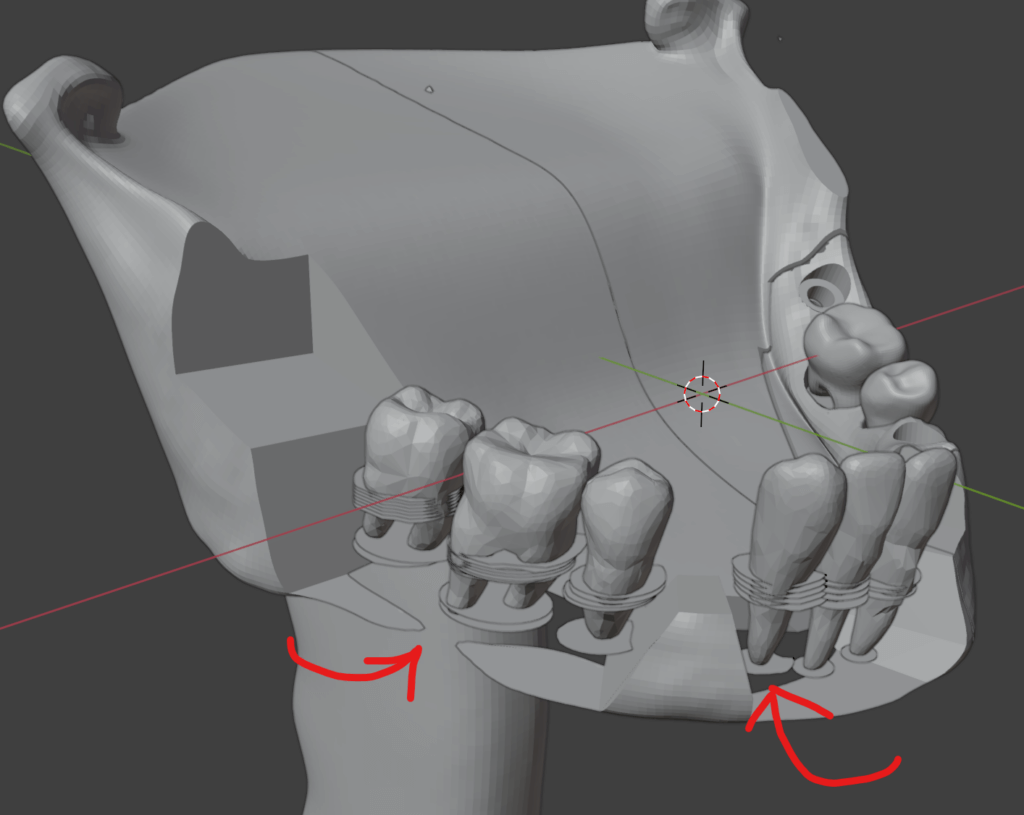 Disc-shaped periodontal ligaments proved to perform the best